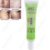 Aloe Acne Remover -cod 0033